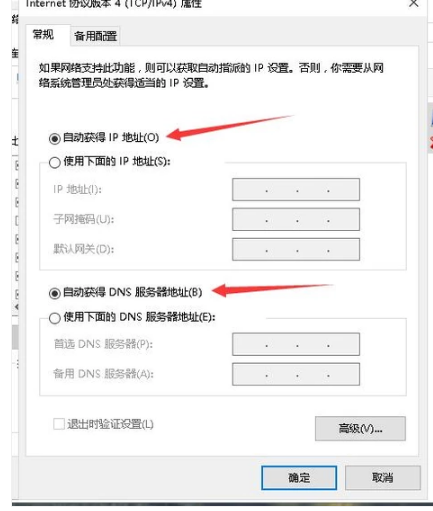 获取网络,一直显示,正在获取,网络地址